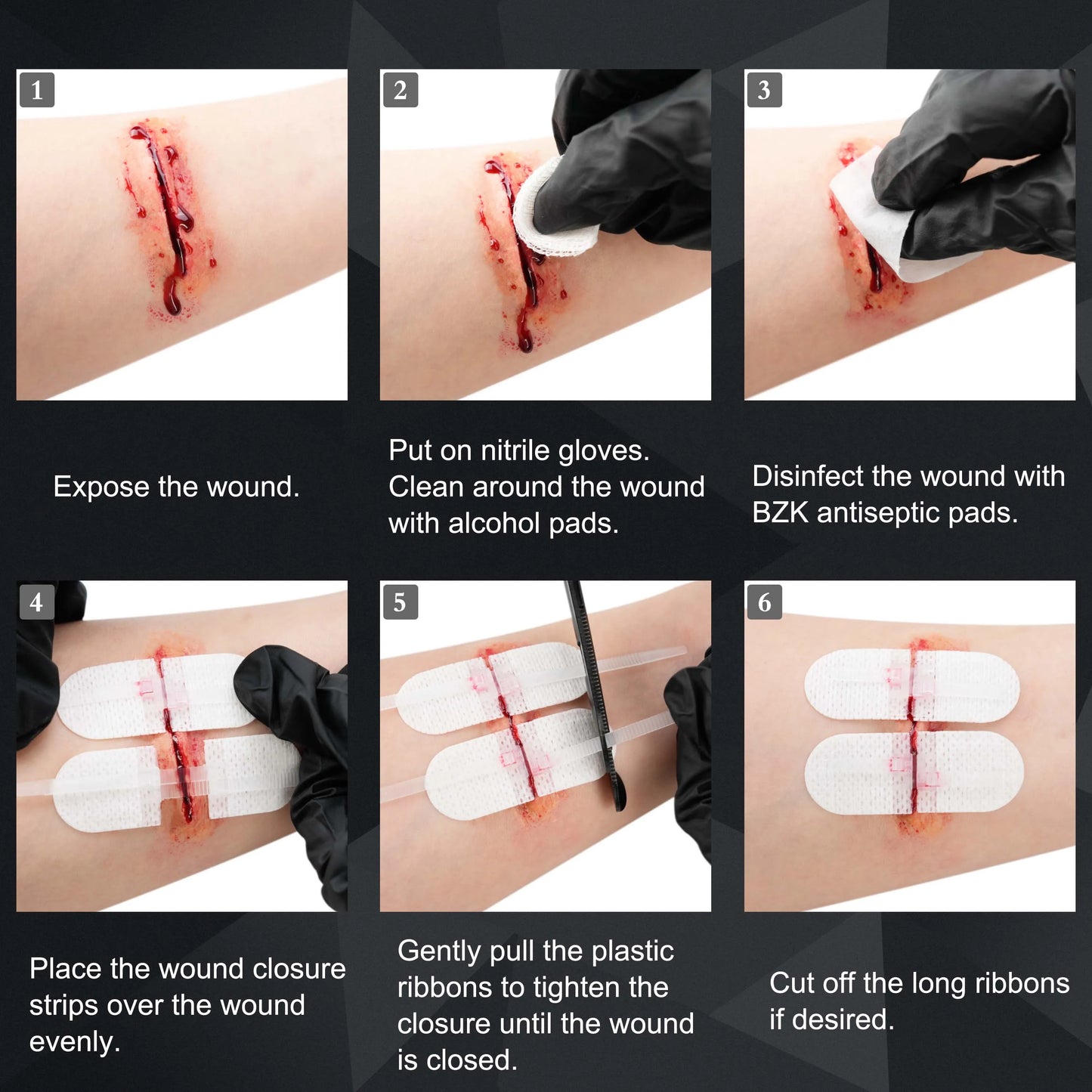 Surgical Quality Laceration Repair Without Stitches - Includes Gauze & Antiseptic Wipe - RHINORESCUE Emergency Wound Closure Strip Kit