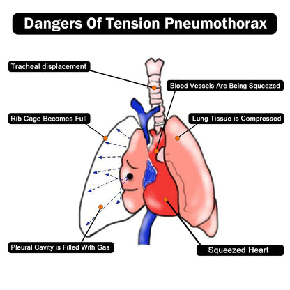 Emergency First Aid Kit Tension Pneumothorax Thoracic Needle – Medical Chest Decompression Needle for Emergency Chest Relief